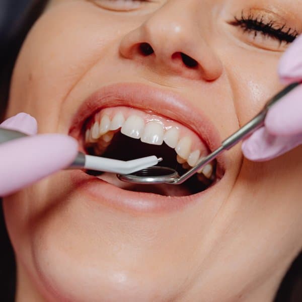 Dental Implants
